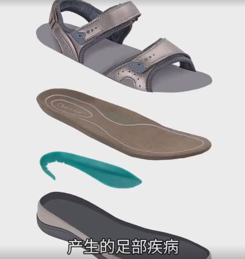 定制輕量化矯形鞋墊-拓撲優化與3D打印的完美結合